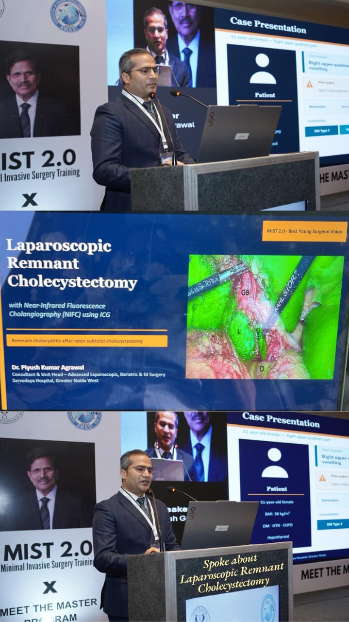 Laparoscopic Surgeon in Noida
